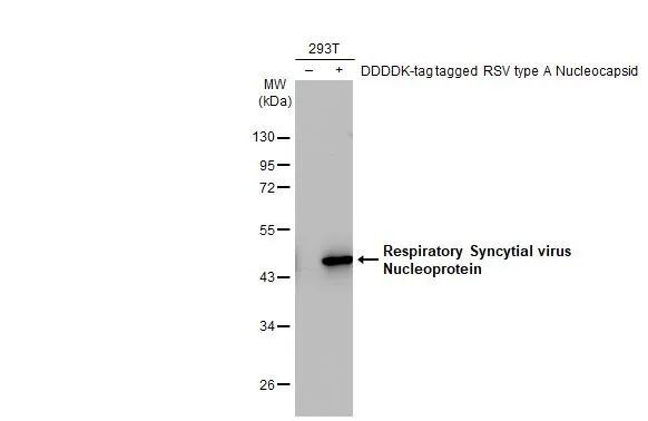 RSV NP Antibody in Western Blot (WB)