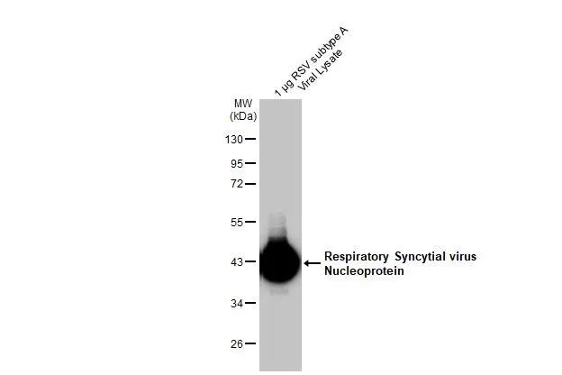 RSV NP Antibody in Western Blot (WB)