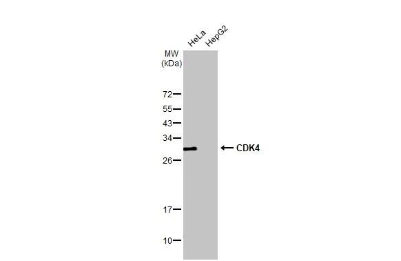 CDK4 Antibody in Western Blot (WB)