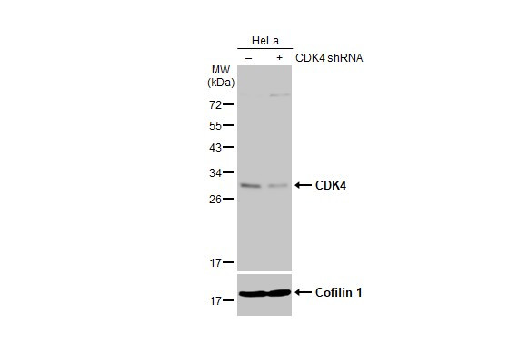 CDK4 Antibody in Western Blot (WB)