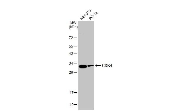 CDK4 Antibody in Western Blot (WB)