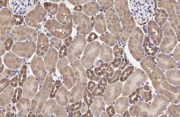 MC1R Antibody in Immunohistochemistry (Paraffin) (IHC (P))