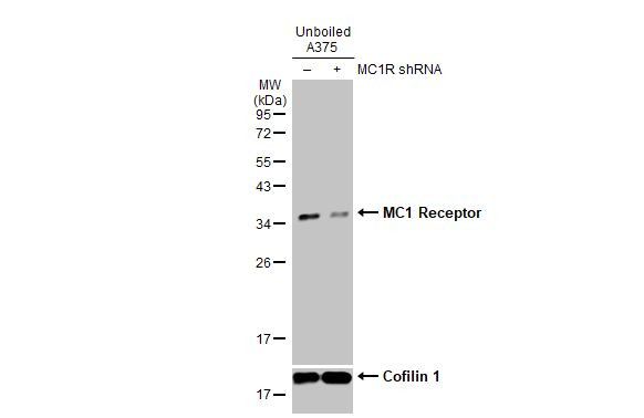 MC1R Antibody in Western Blot (WB)