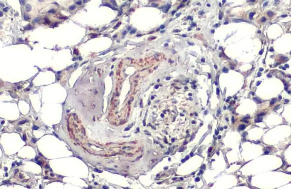 SOD2 Antibody in Immunohistochemistry (Paraffin) (IHC (P))