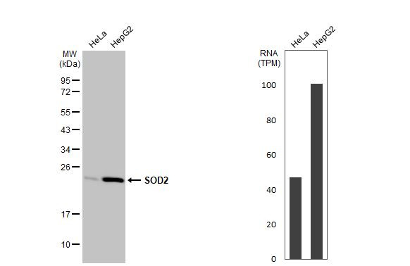 SOD2 Antibody in Western Blot (WB)