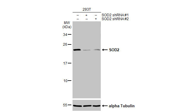 SOD2 Antibody in Western Blot (WB)