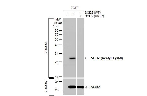 SOD2 Antibody in Western Blot (WB)