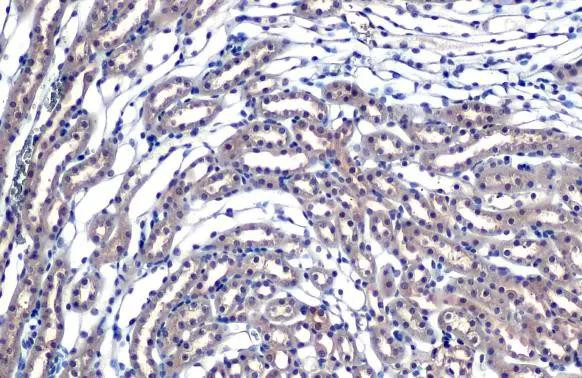 eIF4E Antibody in Immunohistochemistry (Paraffin) (IHC (P))