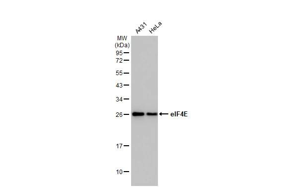 eIF4E Antibody in Western Blot (WB)