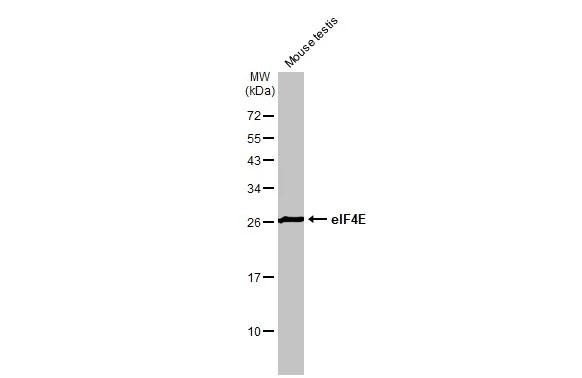 eIF4E Antibody in Western Blot (WB)