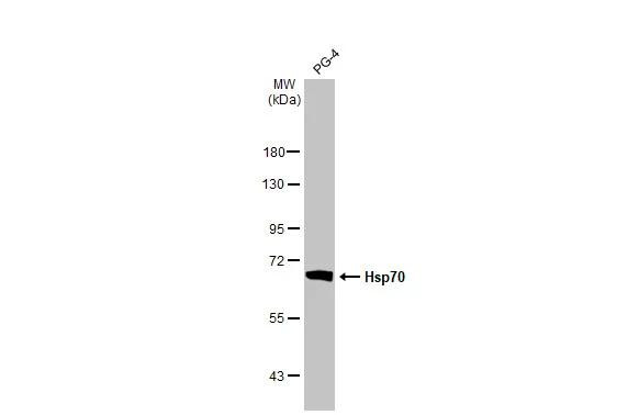 HSP70 Antibody in Western Blot (WB)