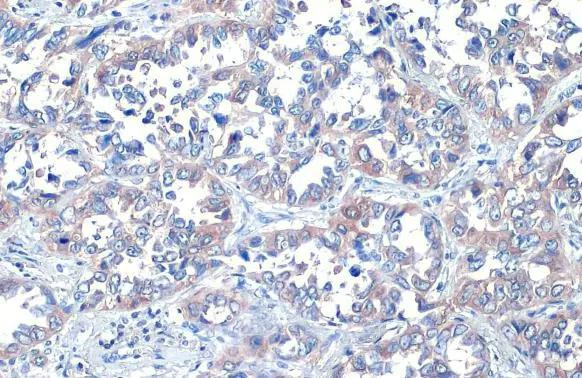 ROCK1/ROCK2 Antibody in Immunohistochemistry (Paraffin) (IHC (P))