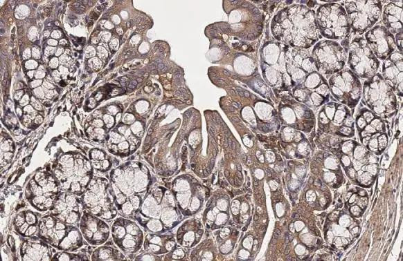 ROCK1/ROCK2 Antibody in Immunohistochemistry (Paraffin) (IHC (P))