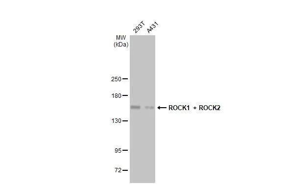 ROCK1/ROCK2 Antibody in Western Blot (WB)