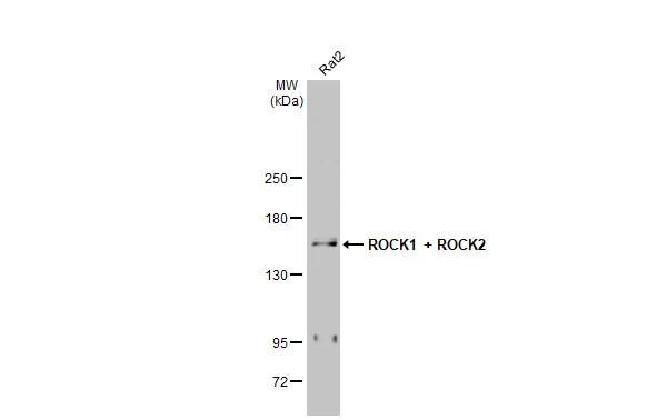 ROCK1/ROCK2 Antibody in Western Blot (WB)