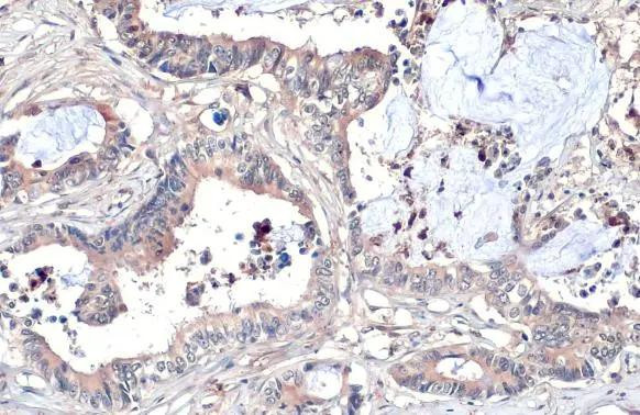 WNT8A Antibody in Immunohistochemistry (Paraffin) (IHC (P))