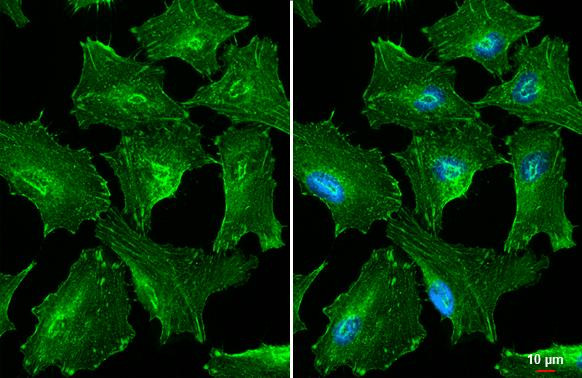 alpha Actinin 2 Antibody in Immunocytochemistry (ICC/IF)