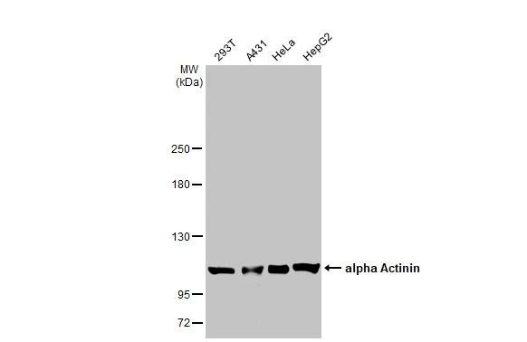 alpha Actinin 2 Antibody in Western Blot (WB)