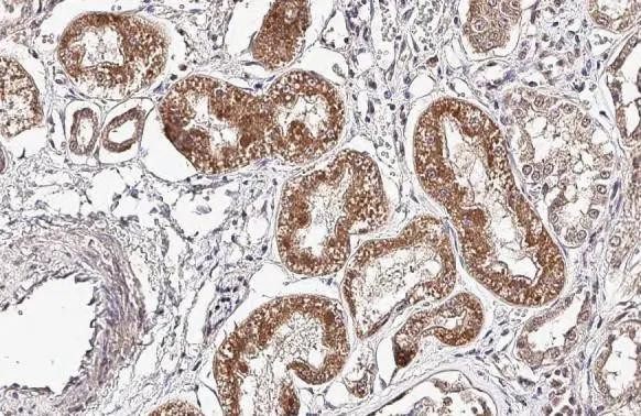 VEGF Antibody in Immunohistochemistry (Paraffin) (IHC (P))