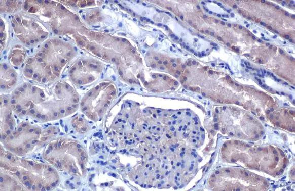 VEGF Antibody in Immunohistochemistry (Paraffin) (IHC (P))