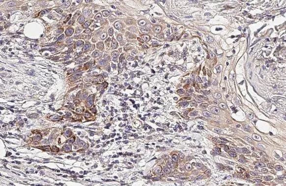 CYP24A1 Antibody in Immunohistochemistry (Paraffin) (IHC (P))