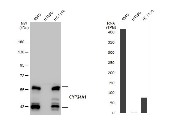 CYP24A1 Antibody in Western Blot (WB)