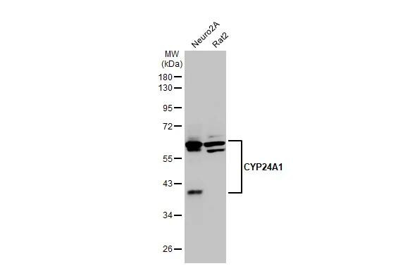 CYP24A1 Antibody in Western Blot (WB)