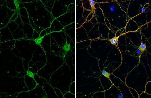 Calbindin/Calretinin Antibody in Immunocytochemistry (ICC/IF)