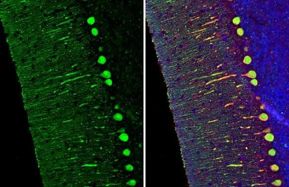 Calbindin/Calretinin Antibody in Immunohistochemistry (Paraffin) (IHC (P))