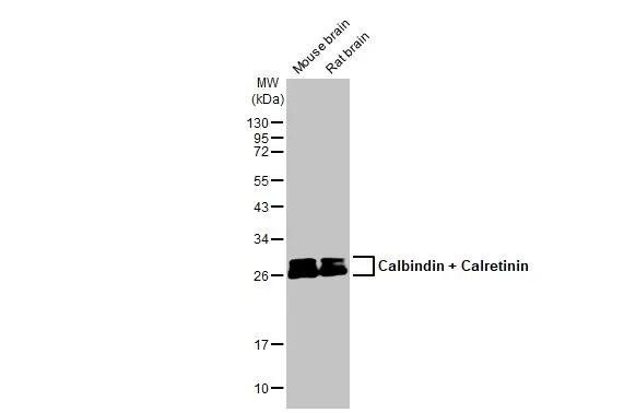 Calbindin/Calretinin Antibody in Western Blot (WB)