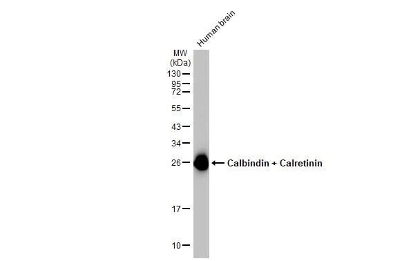 Calbindin/Calretinin Antibody in Western Blot (WB)