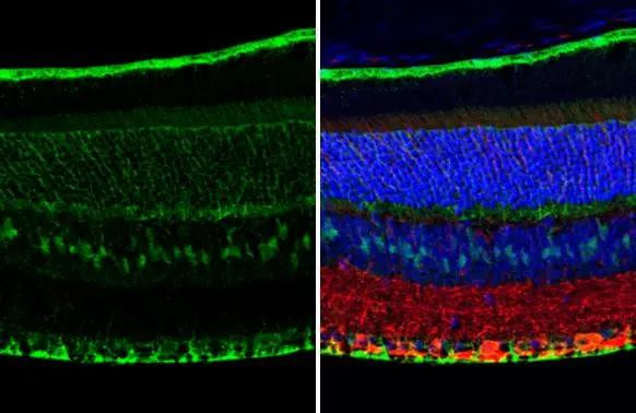 CRALBP Antibody in Immunohistochemistry (Paraffin) (IHC (P))