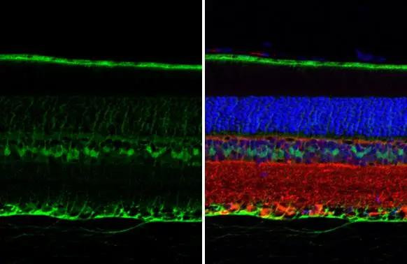 CRALBP Antibody in Immunohistochemistry (Paraffin) (IHC (P))