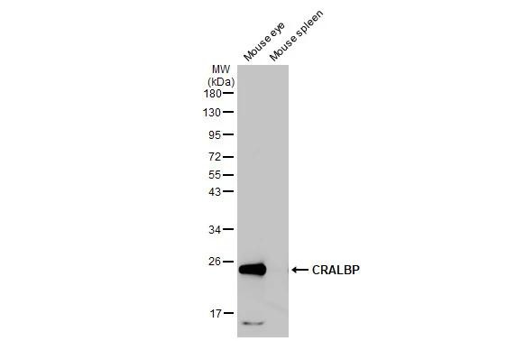 CRALBP Antibody in Western Blot (WB)