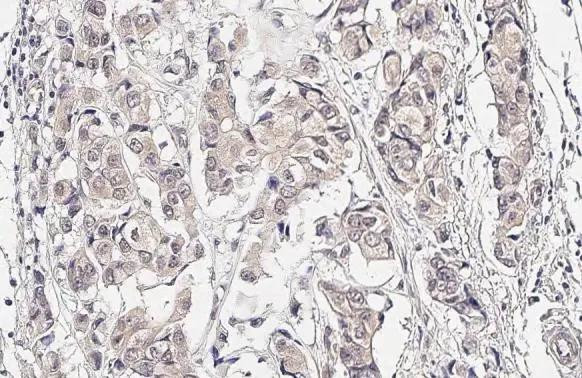 MAP2K4 Antibody in Immunohistochemistry (Paraffin) (IHC (P))