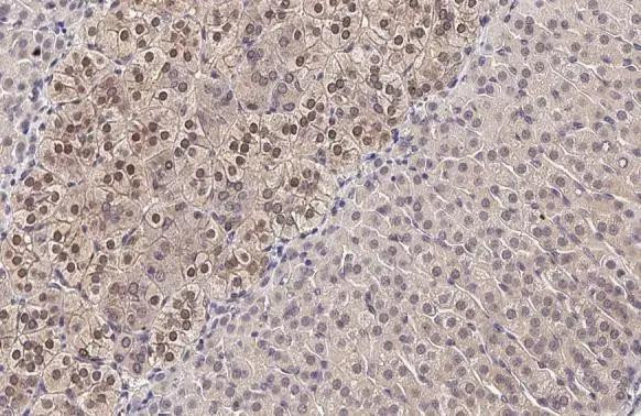 MAP2K4 Antibody in Immunohistochemistry (Paraffin) (IHC (P))