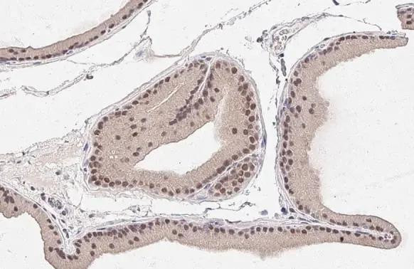 MAP2K4 Antibody in Immunohistochemistry (Paraffin) (IHC (P))