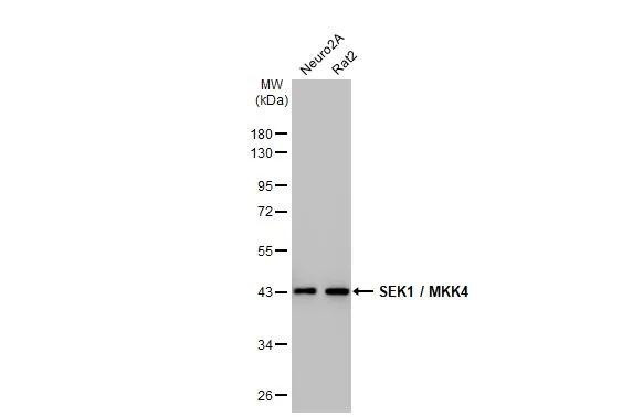 MAP2K4 Antibody in Western Blot (WB)