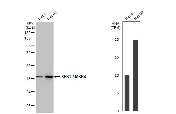 MAP2K4 Antibody in Western Blot (WB)