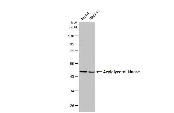 AGK Antibody in Western Blot (WB)