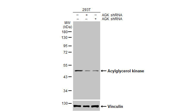 AGK Antibody in Western Blot (WB)