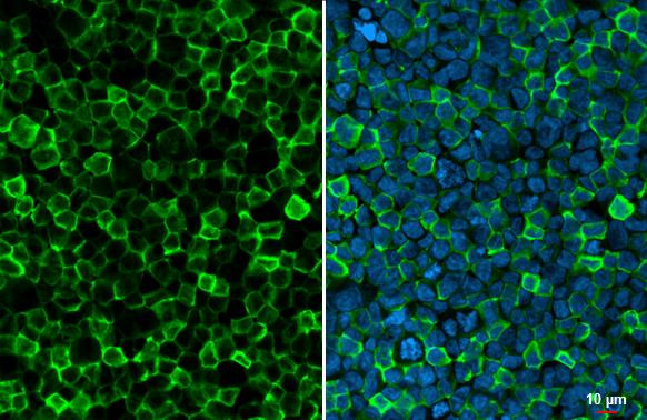 IBA1 Antibody in Immunocytochemistry (ICC/IF)