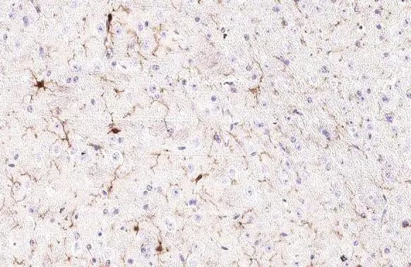 IBA1 Antibody in Immunohistochemistry (Paraffin) (IHC (P))