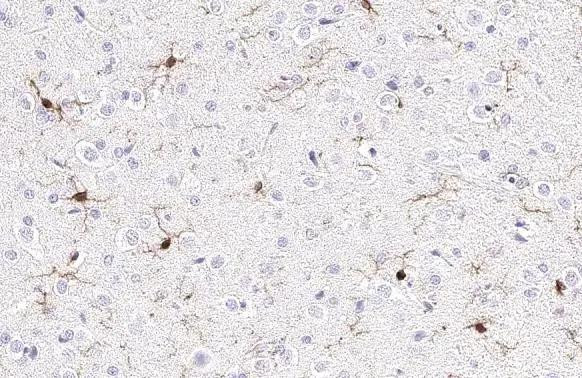 IBA1 Antibody in Immunohistochemistry (Paraffin) (IHC (P))