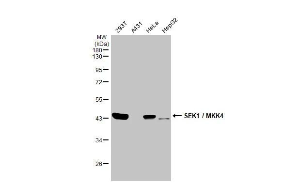 MAP2K4 Antibody in Western Blot (WB)