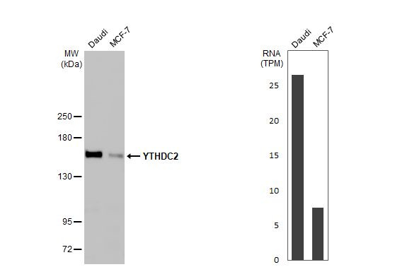 YTHDC2 Antibody in Western Blot (WB)