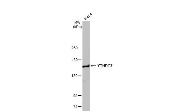 YTHDC2 Antibody in Western Blot (WB)