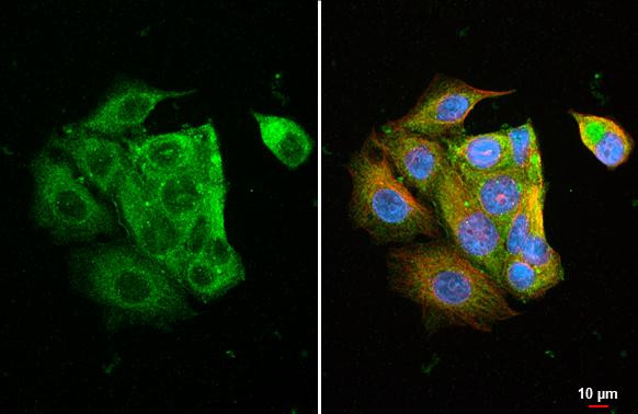 Ly-6E Antibody in Immunocytochemistry (ICC/IF)