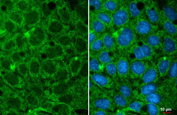 GPD1 Antibody in Immunocytochemistry (ICC/IF)