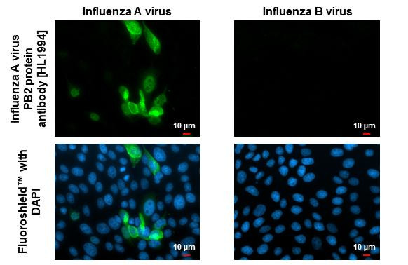 Influenza A H1N1 PB2 (A/Puerto Rico/8/34) Antibody in Immunocytochemistry (ICC/IF)